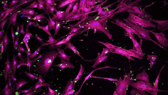 有望在再生医学领域“大显身手”，新型多孔纳米颗粒可引导干细胞形成骨骼