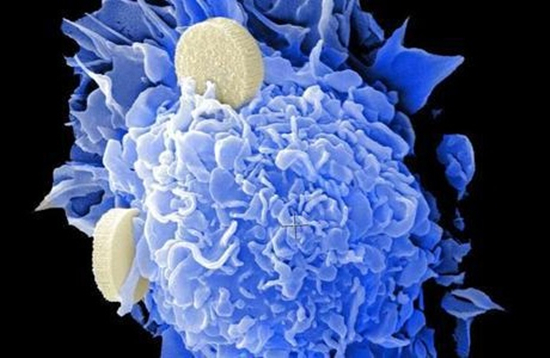 研究发现 癌症修复机制或是潜在药物靶点